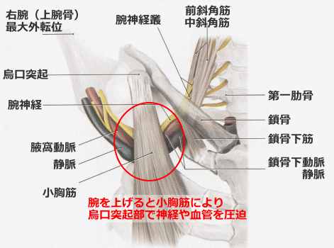 小胸筋による圧迫箇所