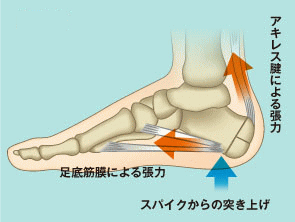 踵骨骨端症の痛みの部位