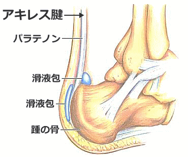 アキレス腱炎やアキレス腱周囲炎の構造