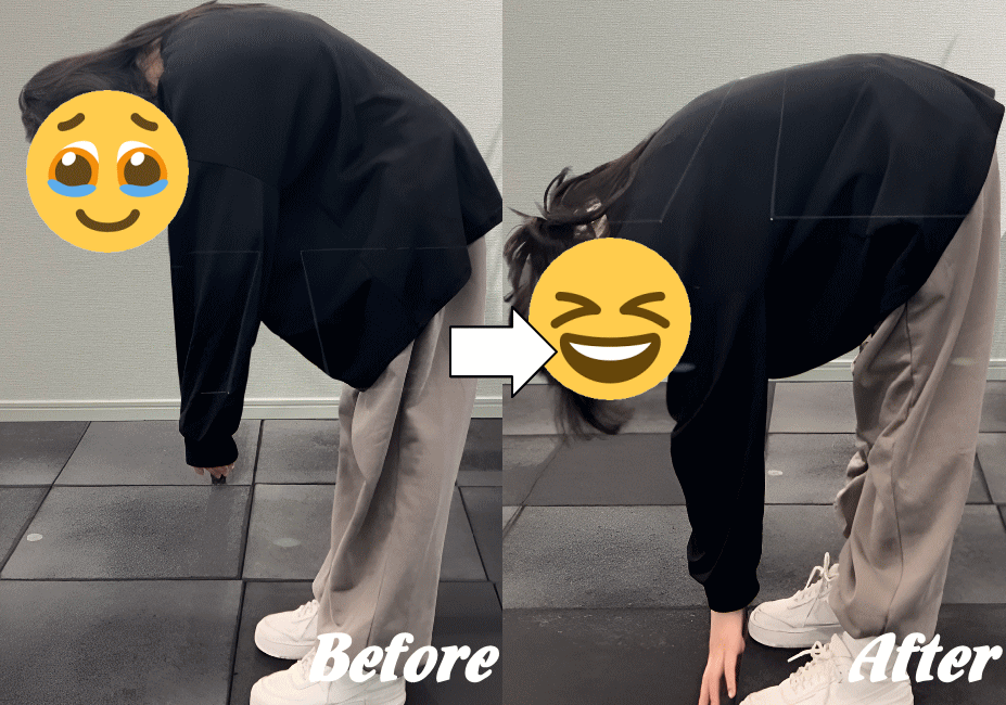 ぎっくり腰の施術の変化１