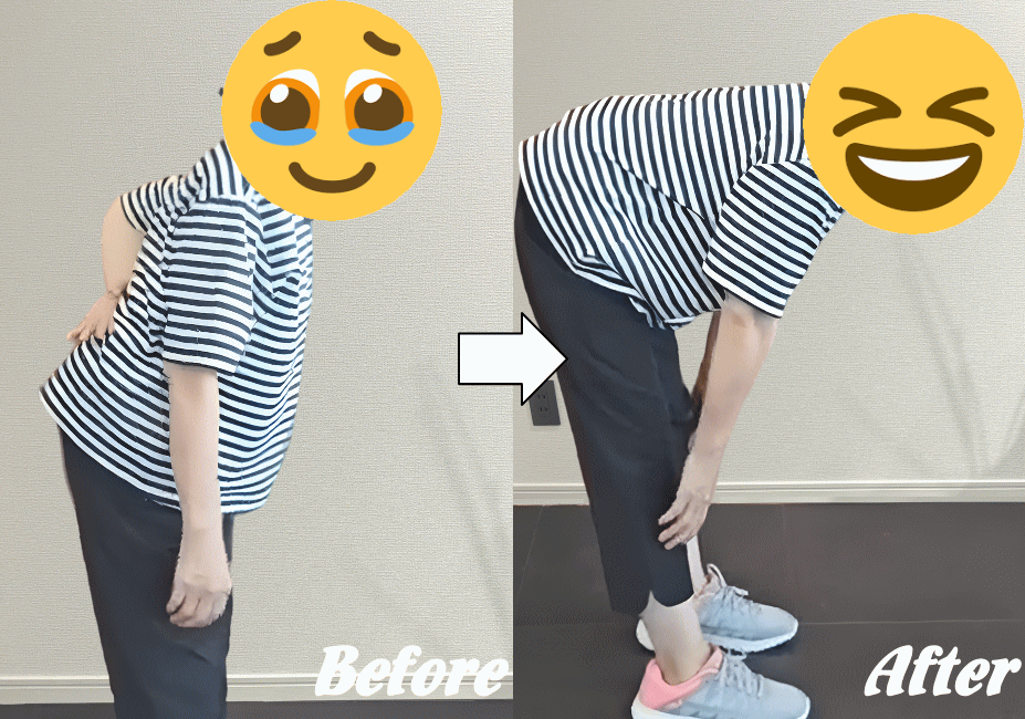 ぎっくり腰の施術の変化２