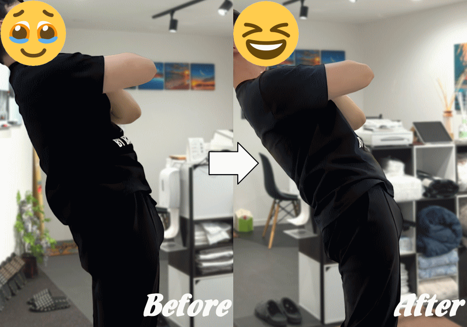 ぎっくり腰の施術の変化３