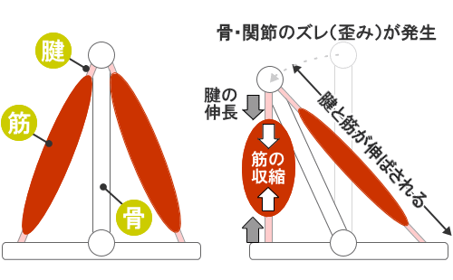 カイロプラクティック マニピュレーション反射テクニック