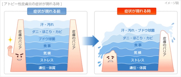 アトピー性皮膚炎が現れる状態
