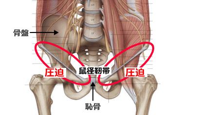 大腿神経痛の発生個所