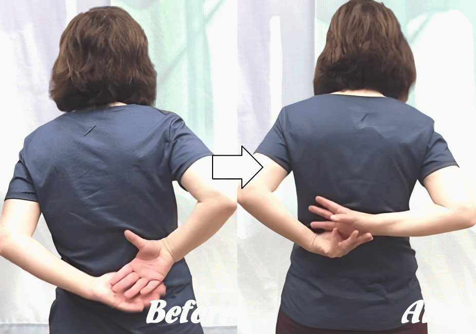 五十肩の施術の変化6