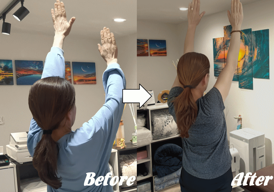 五十肩の施術の変化4