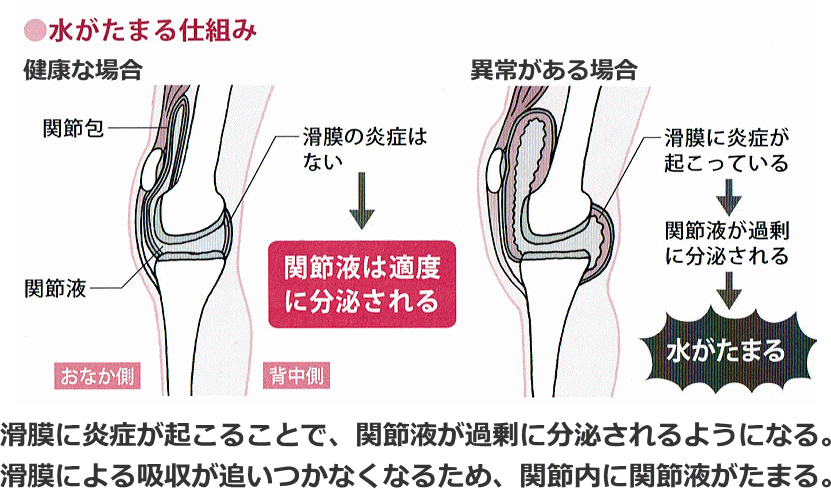 水がたまる仕組み