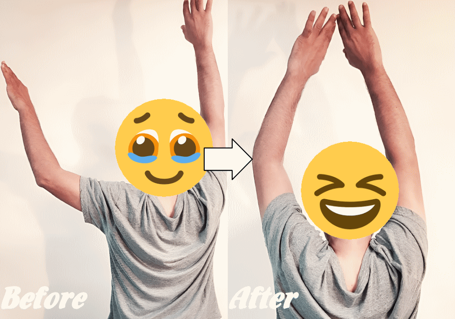 インピンジメント症候群の改善例2