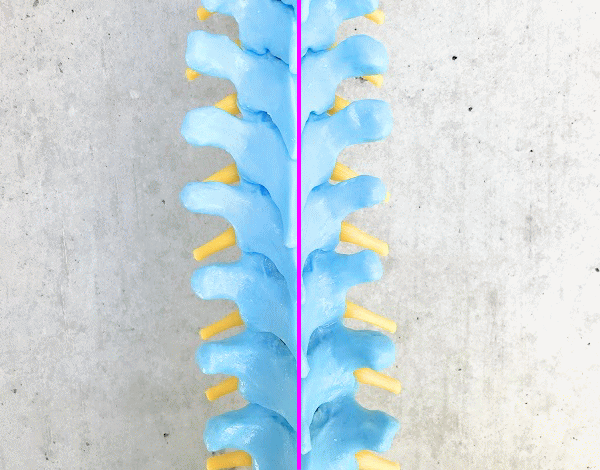 正常な脊柱