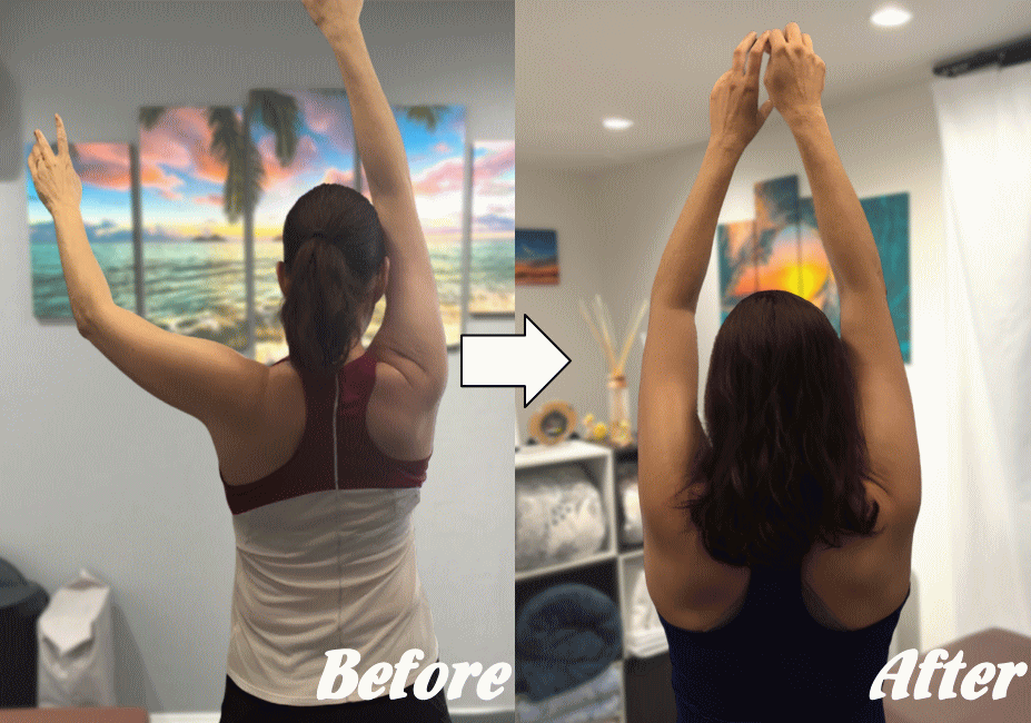 施術前と施術後28