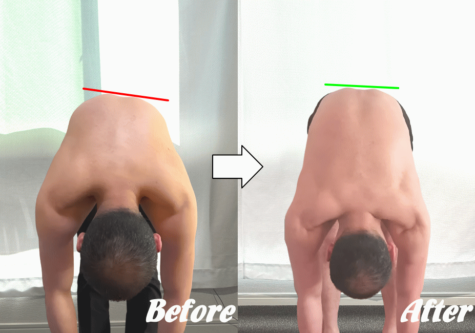 施術前と施術後29