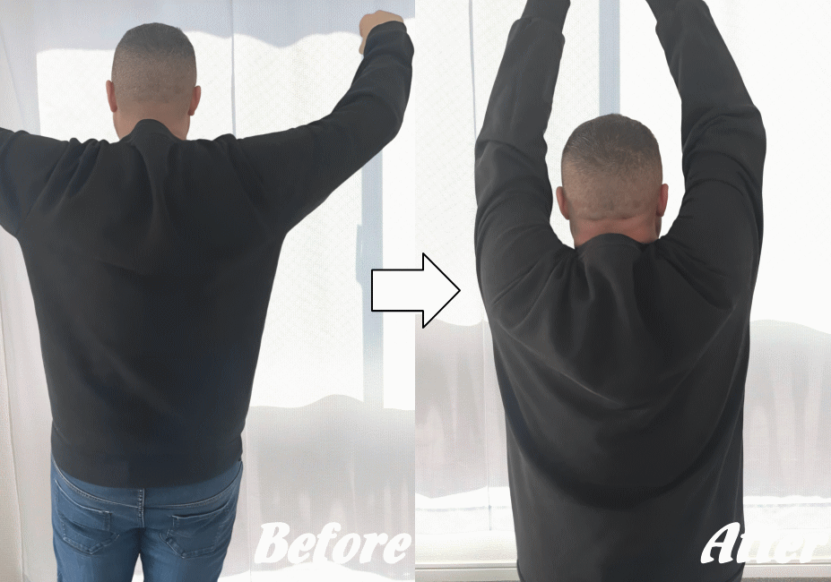 施術前と施術後30