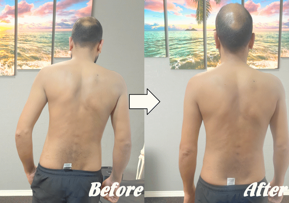 施術前と施術後31