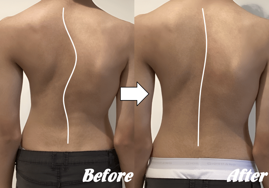 施術前と施術後33