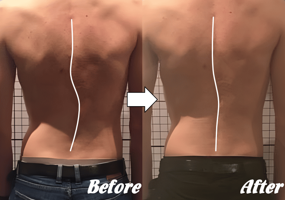 施術前と施術後34