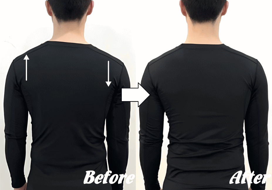 施術前と施術後35