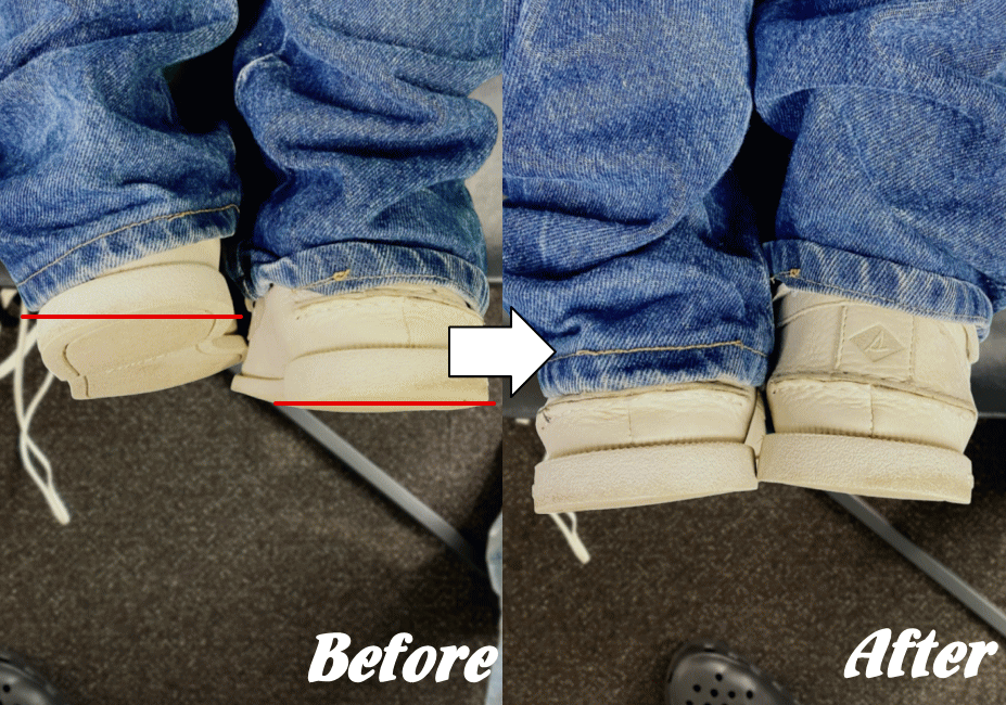 施術前と施術後36