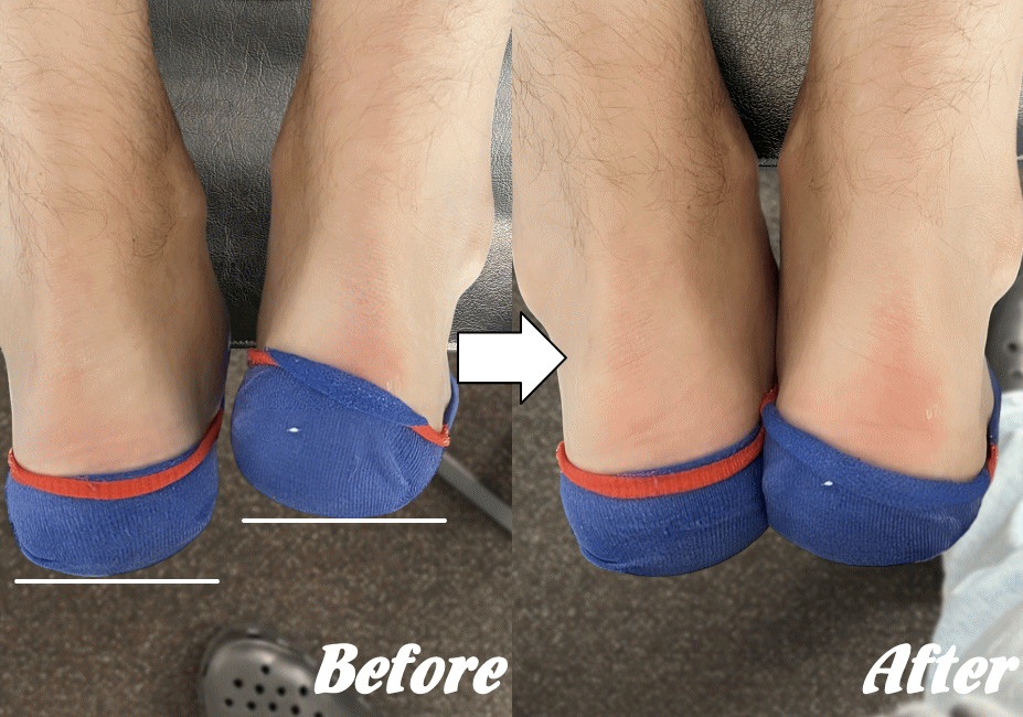 施術前と施術後37