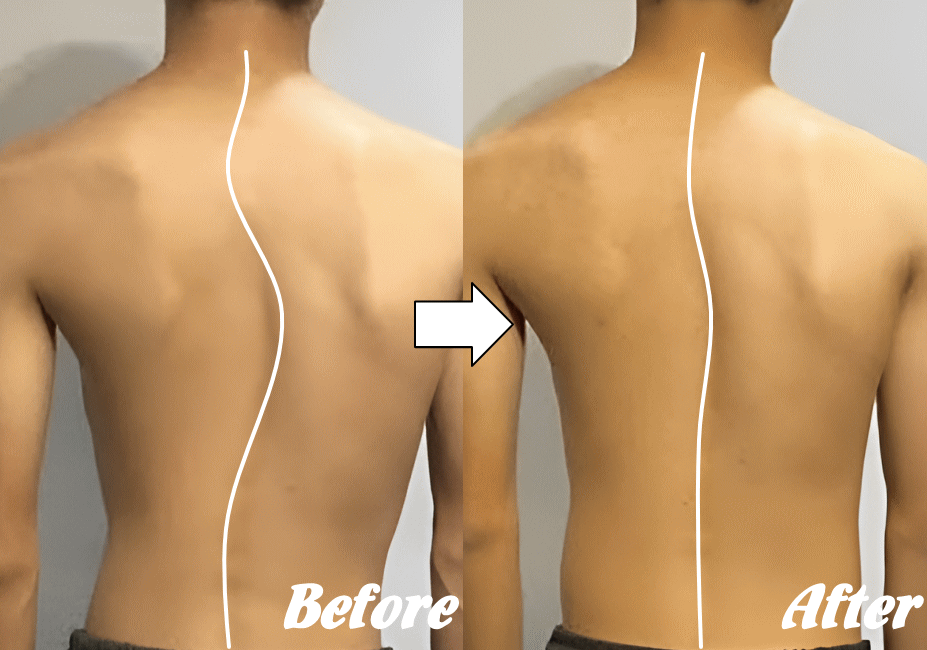 施術前と施術後38