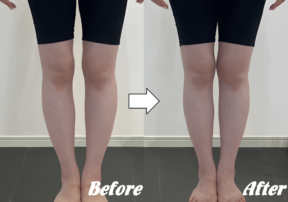 施術前と施術後39