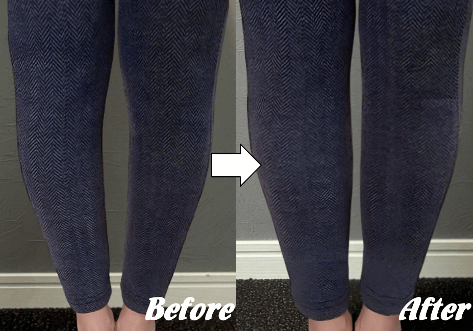 施術前と施術後40