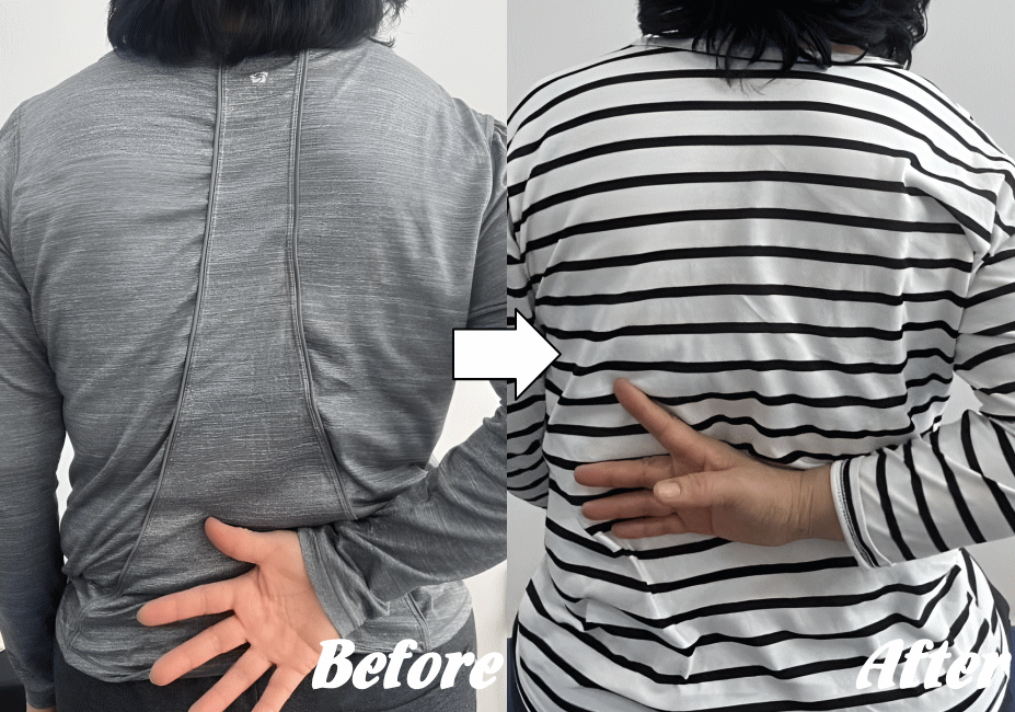 施術前と施術後41