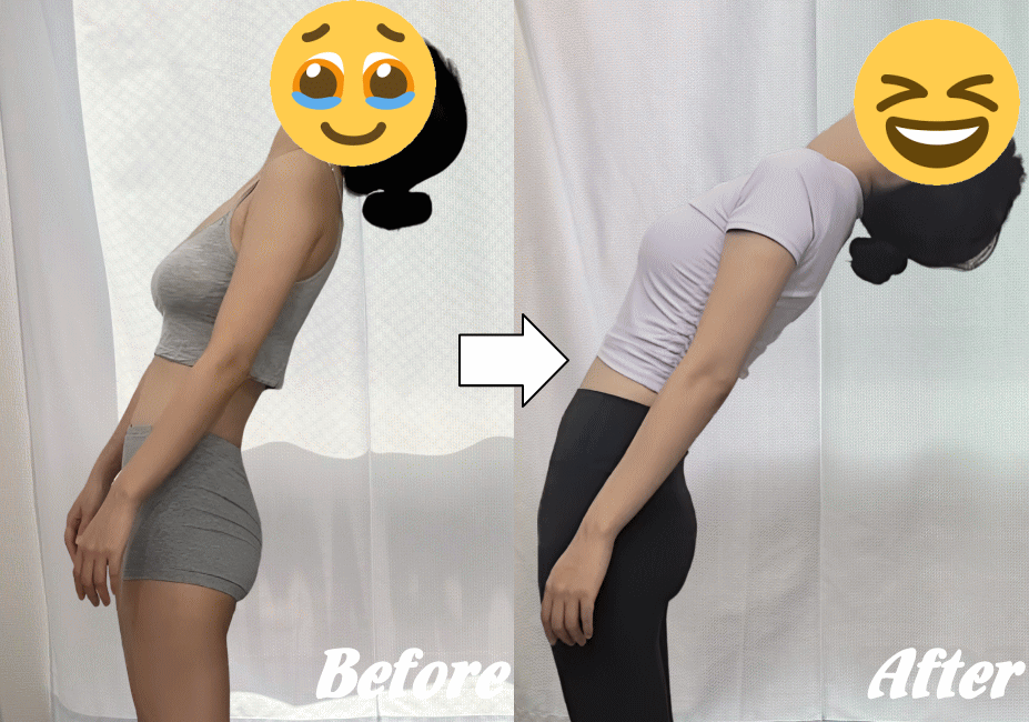 施術前と施術後43