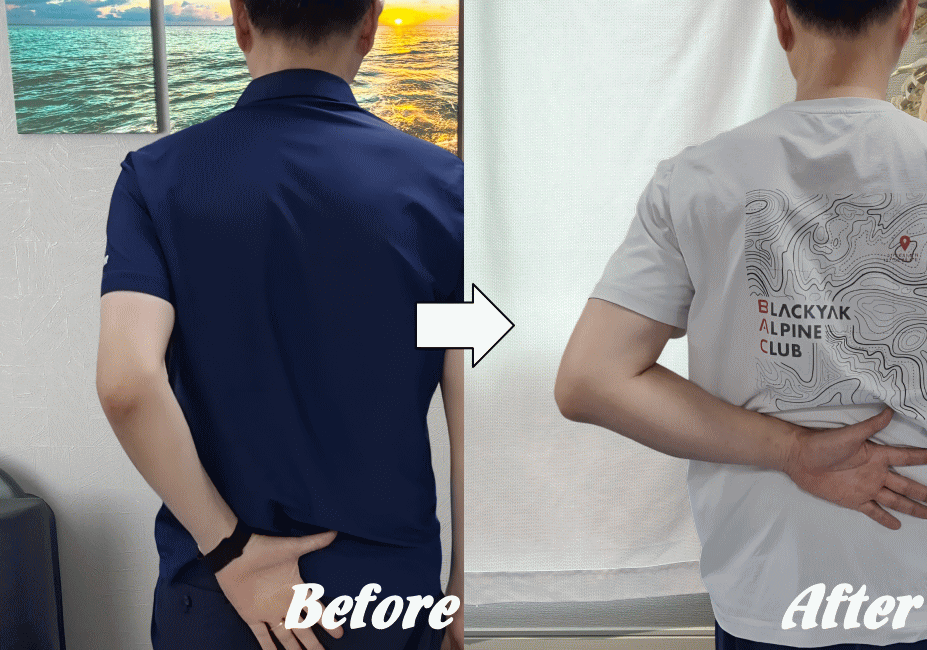 施術前と施術後44