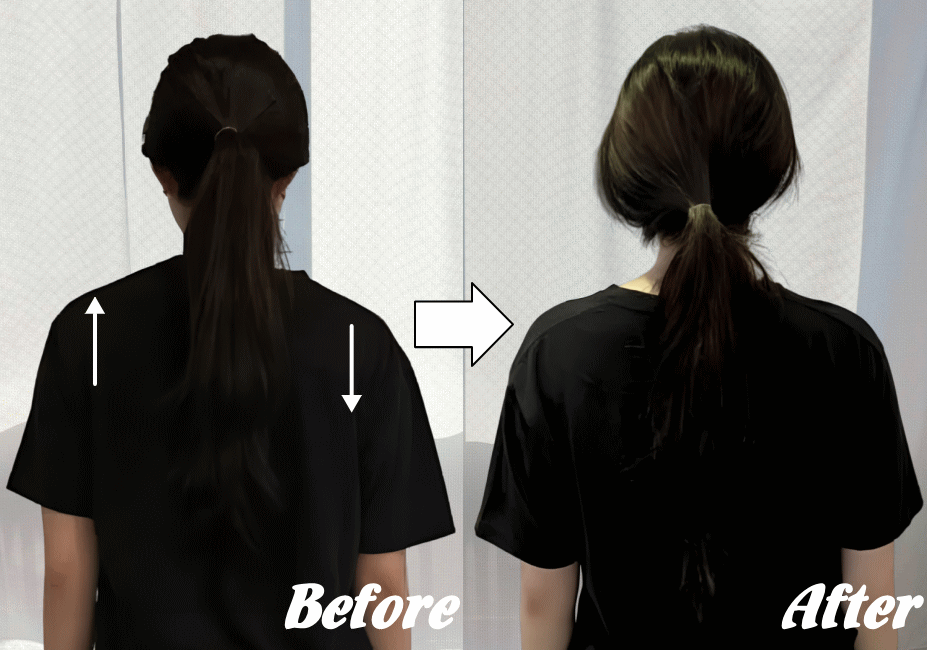 施術前と施術後45