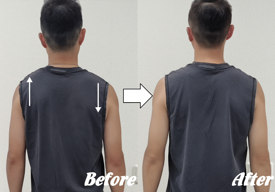 施術前と施術後46