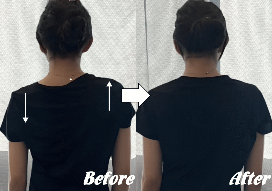 施術前と施術後47