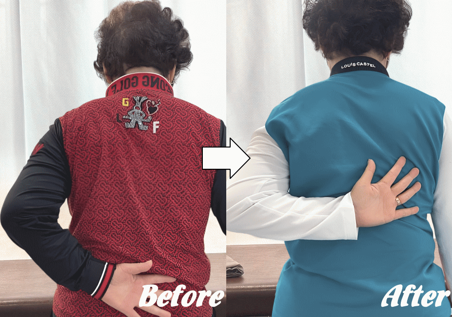 施術前と施術後48