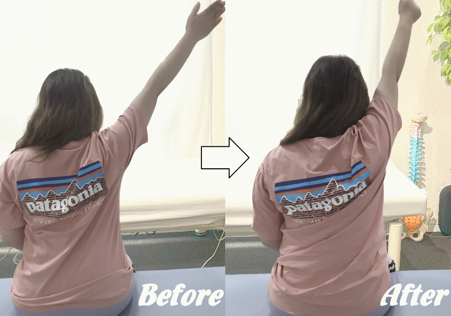 施術前と施術後49