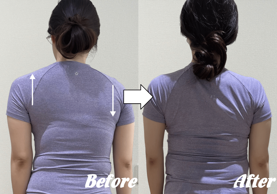 施術前と施術後50