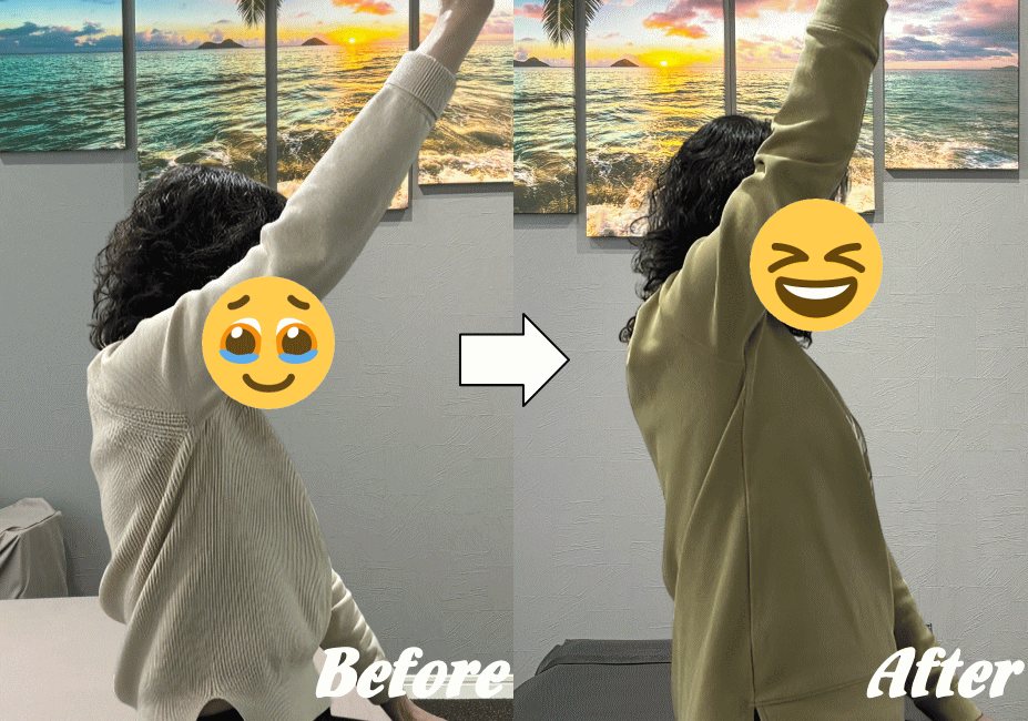 施術前と施術後51