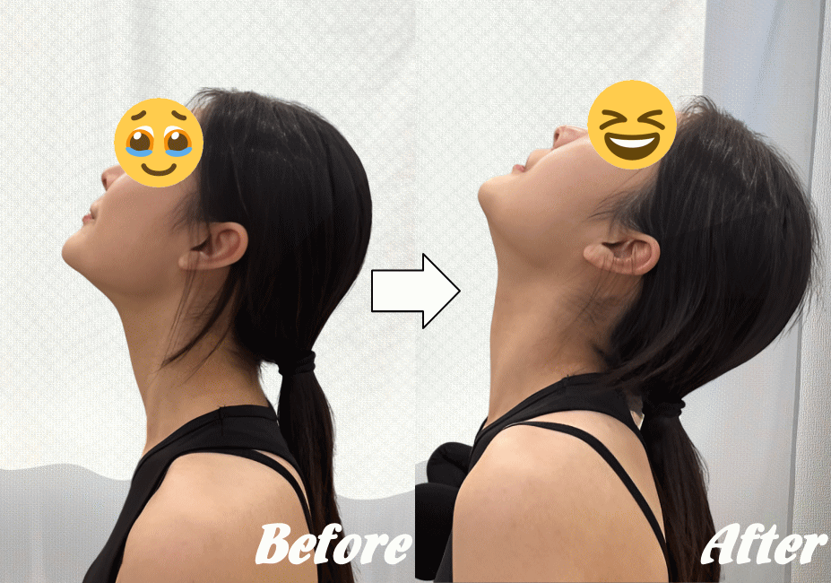 施術前と施術後52