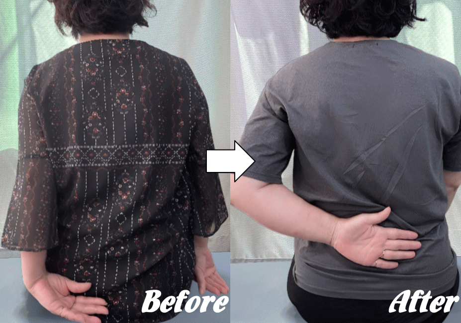 施術前と施術後53