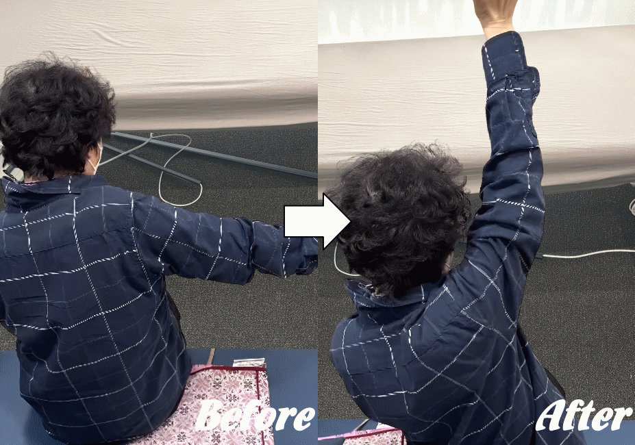 施術前と施術後54