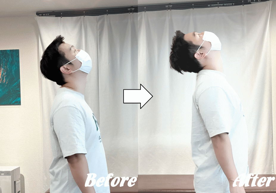 施術前と施術後55