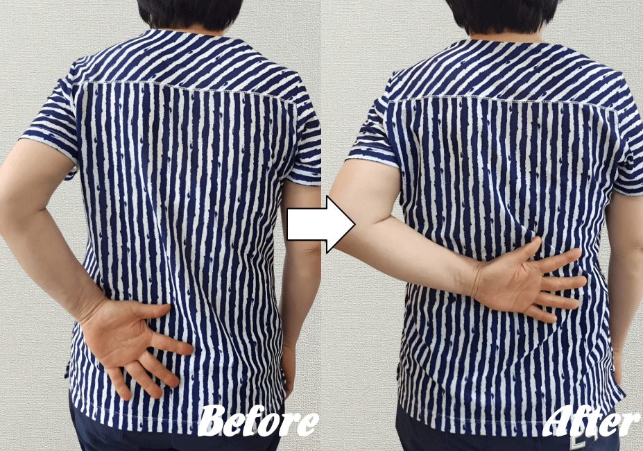 施術前と施術後56