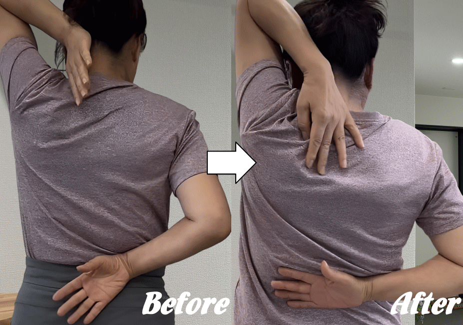 施術前と施術後57