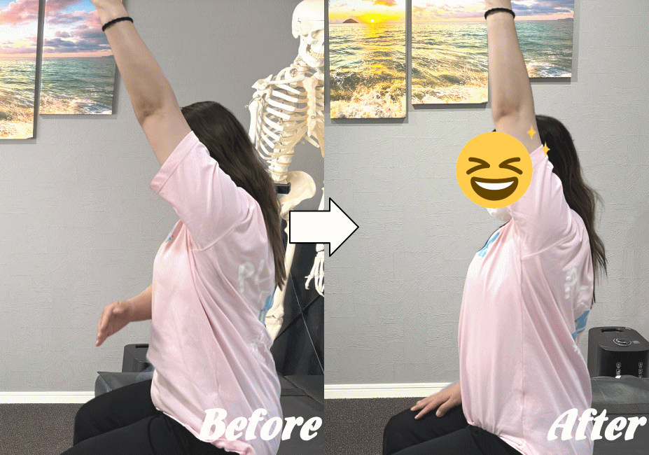 施術前と施術後58