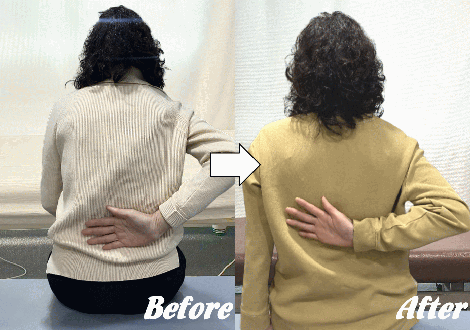 施術前と施術後59