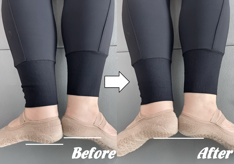 施術前と施術後60