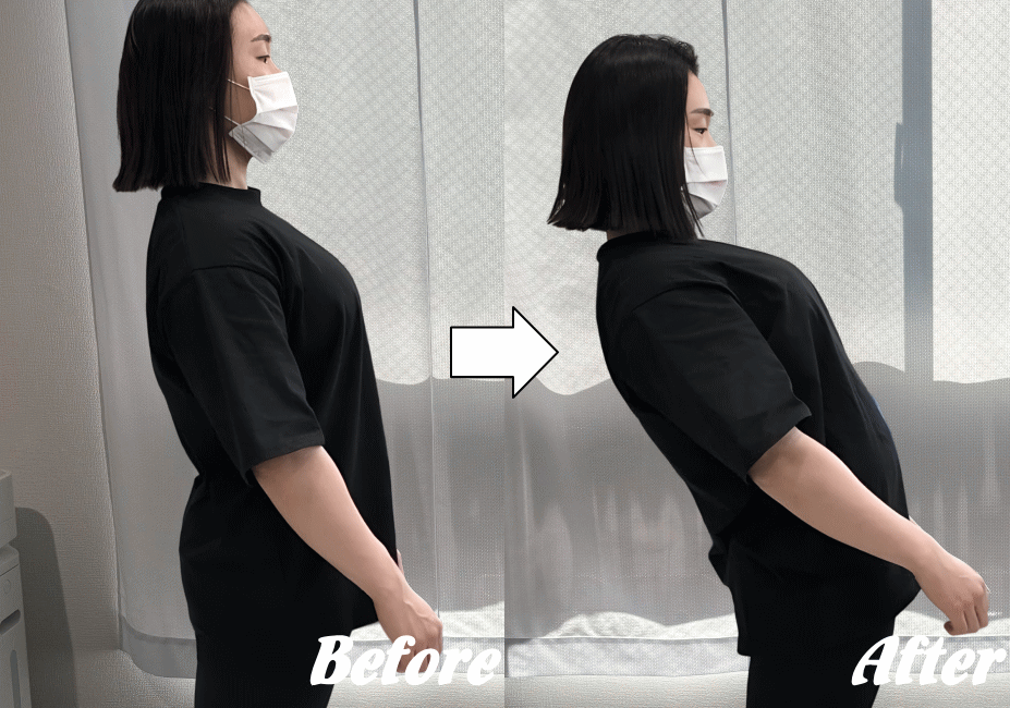 施術前と施術後61