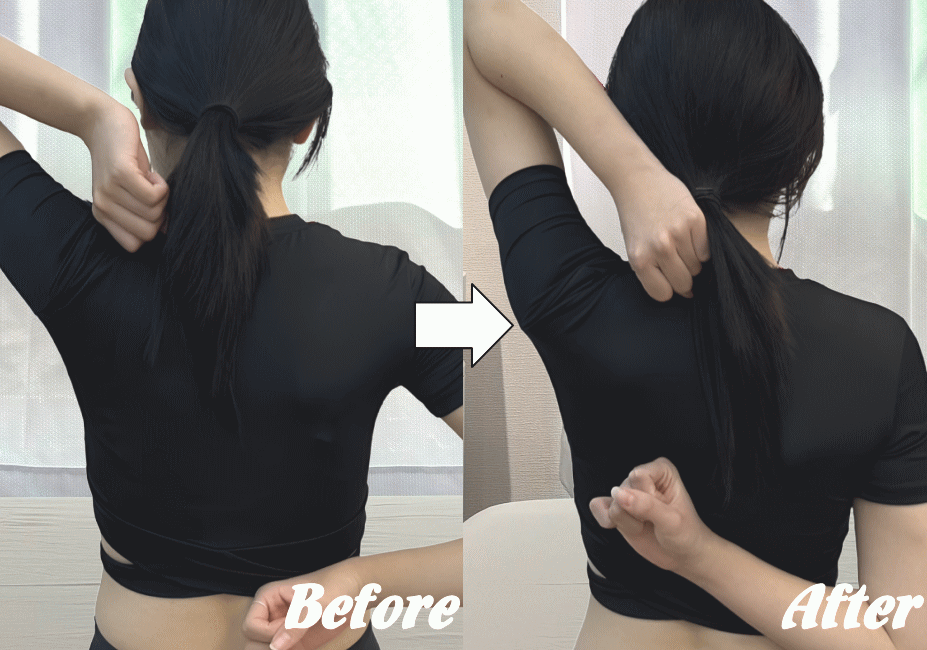 施術前と施術後62