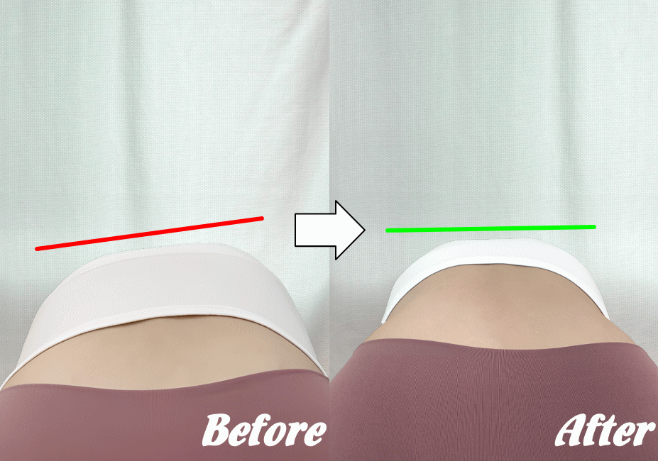 施術前と施術後63