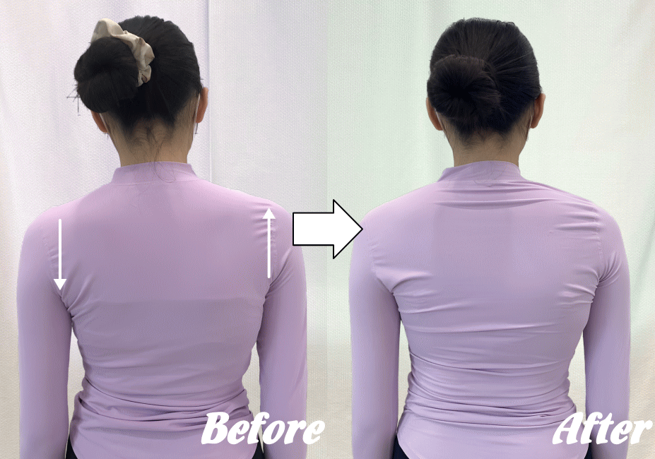 施術前と施術後64