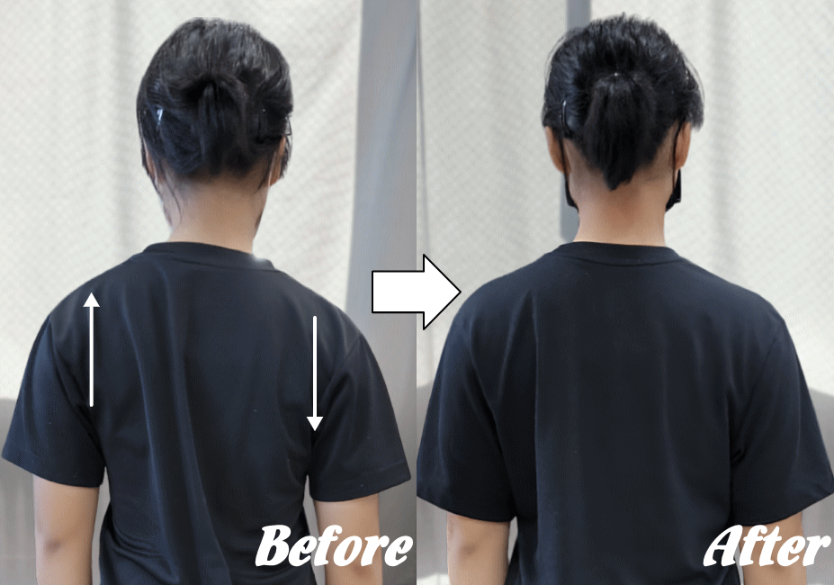 施術前と施術後66